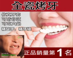 仿真牙套